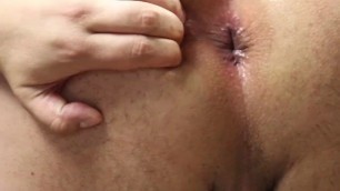 Gaping Teen Asshole